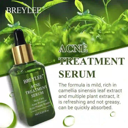 Acne Treatment Serum Face Facial Anti Acne Scar Removal
